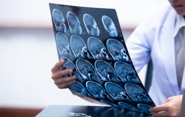 Stroke explained: Recognise the warning signs and act fast