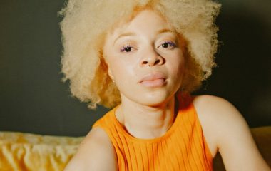 OP-ED | Albinism Awareness Month puts overlooked skin cancer risks in focus