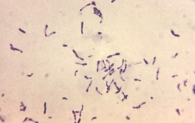 Corynebacterium diphtheriae bacteria in a stained laboratory specimen photographed in 1973